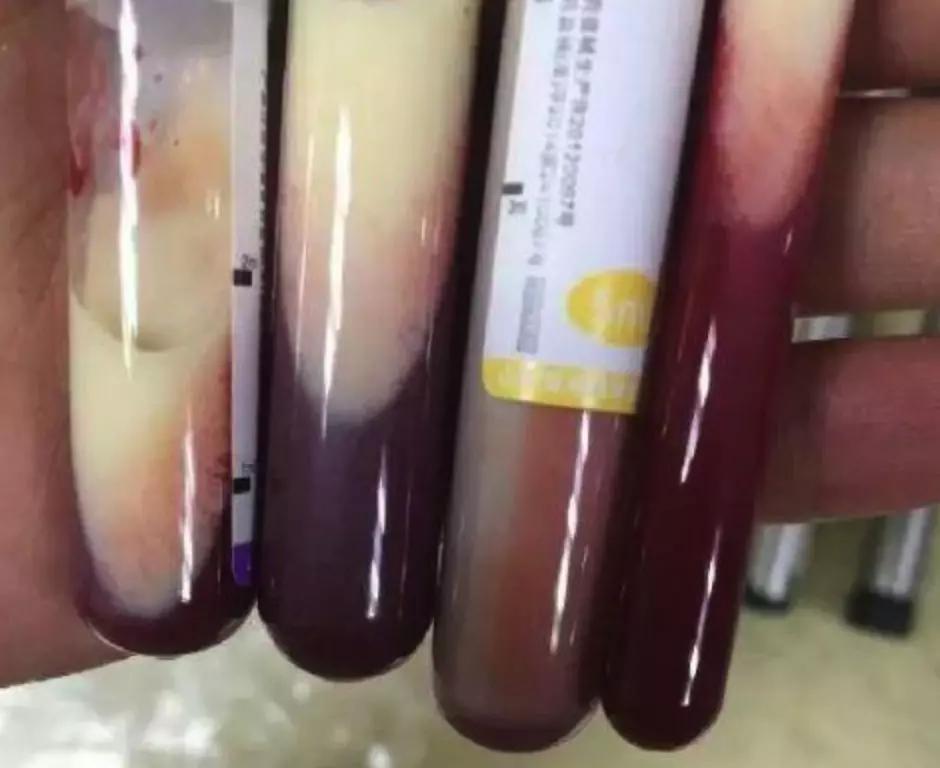 好好吃饭才是最好的爱自己,好好吃饭才是正确的