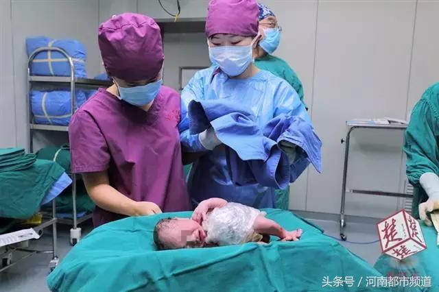 妈妈怀孕了肚子有个裂缝怎么办,孕妇肚子上有妊娠裂纹