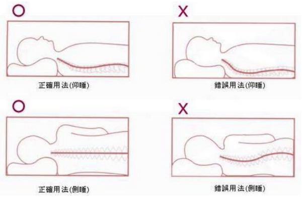 颈椎病患者需要选择什么样的枕头,颈椎病不枕枕头睡觉的好处与弊端