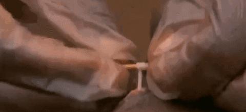 吃活物有寄生虫,吃活的虫子身体里有寄生虫