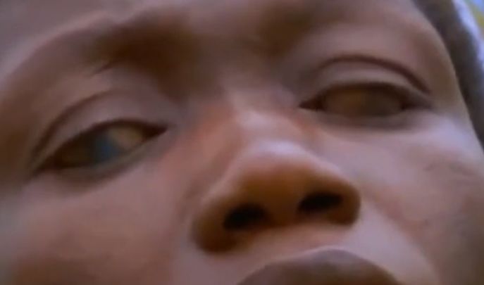 吃活物有寄生虫,吃活的虫子身体里有寄生虫