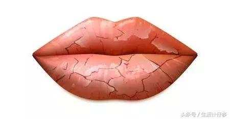 嘴唇开裂让你丑10倍，不花1分钱一招立刻变水润！