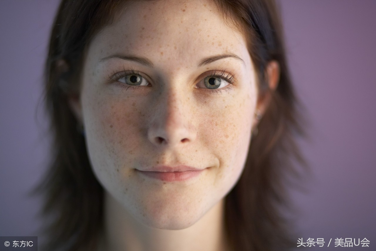 斑点为什么会自然消退,斑点什么时候消除最好