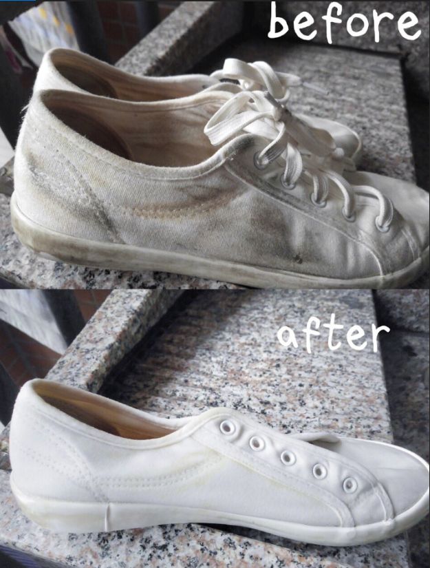 防止白鞋子发黄的小窍门,小白鞋被晒后发黄怎么解决