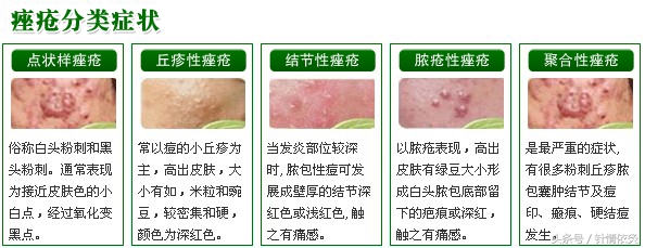 针灸治疗疔疮,蜡疗针灸拔罐治疗顺序