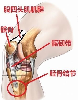小孩膝盖疼痛的原因和解决方法,小孩子跑步膝盖痛是什么原因