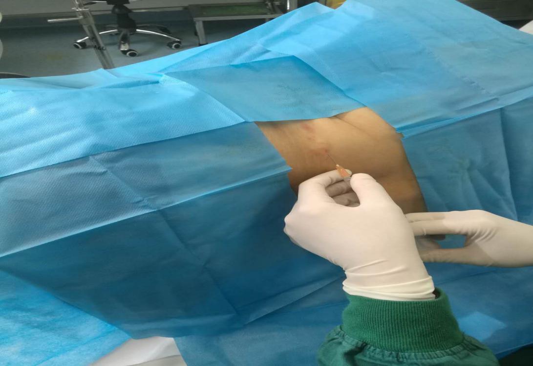 痘痘可以等它自然消失吗,痘痘消不掉有颗粒感