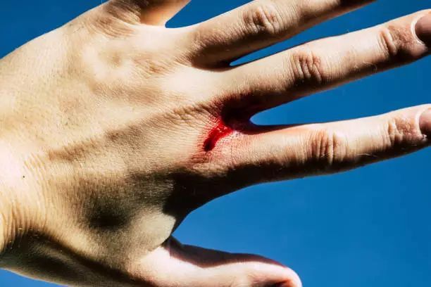 你用它消毒，它却让你“中毒”！这些消毒药水别再用了