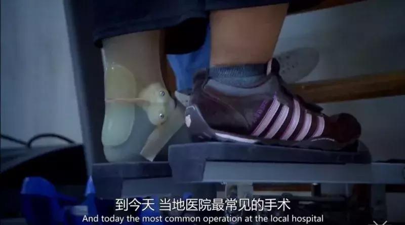 世界上最不健康的饮食习惯,我们有没有不健康的饮食习惯