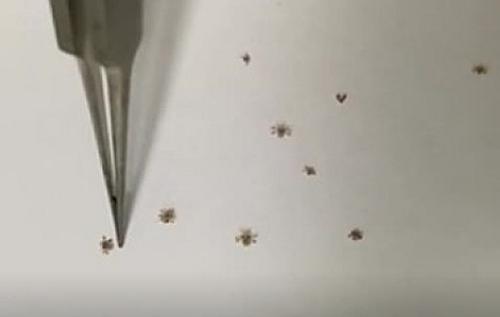 苏州儿童眼科检查,苏州儿童医院眼科医生