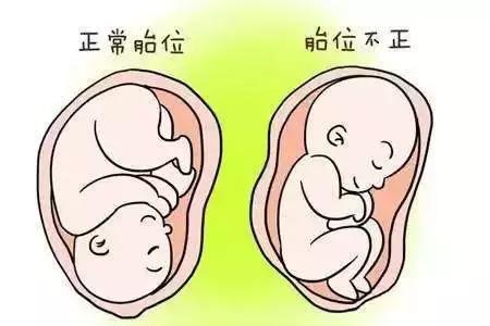 该顺还是该剖？知道这些或许医患矛盾会少一些……