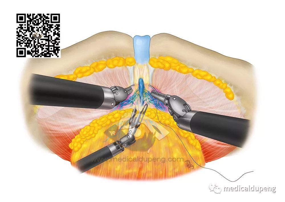 医学插画插图,医学插画sci