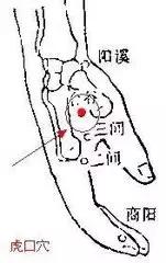 针灸治疼痛药方,针灸治疗各种痛症图解