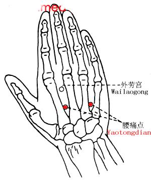 针灸治疼痛药方,针灸治疗各种痛症图解