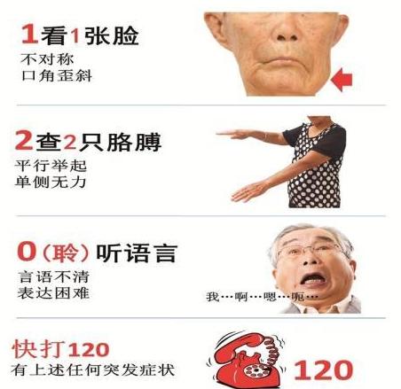 身体有这2个症状，十有八九是脑梗塞，第一时间要打120去医院急诊