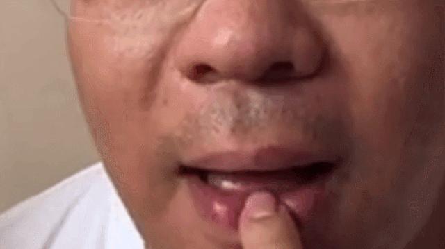 正确的萨克斯音准,萨克斯正确的口型