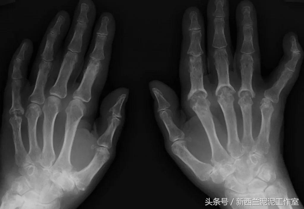 拜耳代表性药物,拜耳有哪些药