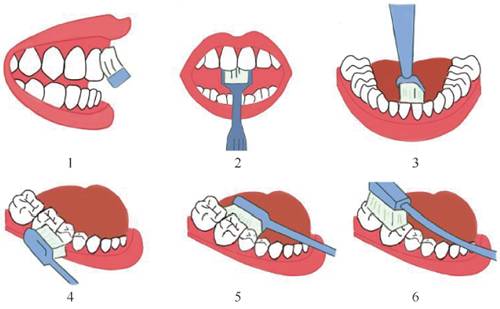 蛀牙智齿该不该拔,成年人蛀牙不管它会怎么样