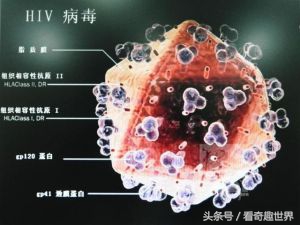 娶越南媳妇一家三口感染艾滋病,娶越南媳妇全家感染艾滋病