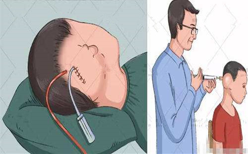 卫健委代涛博士,代涛厦门大学博士