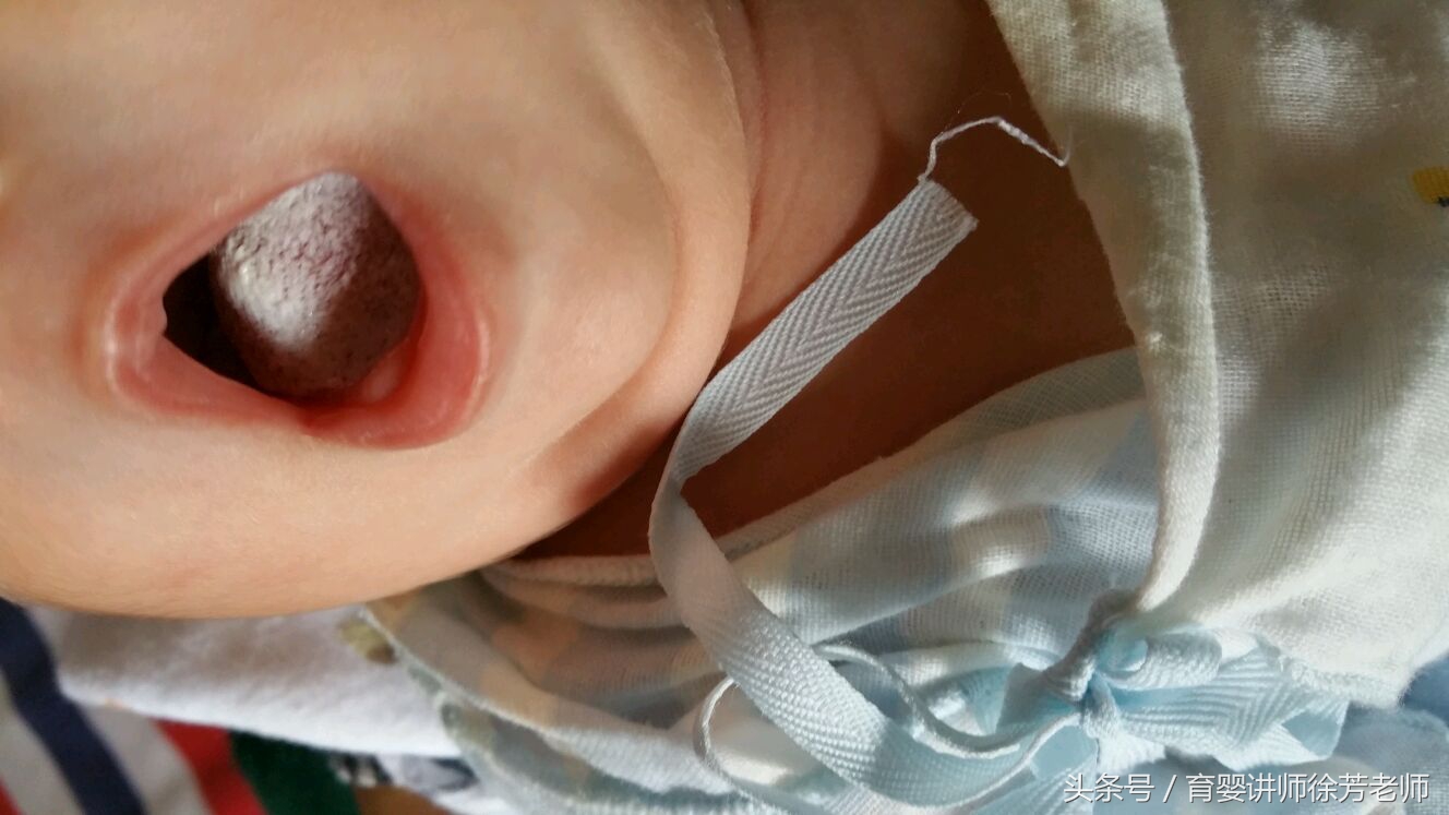 宝宝嘴巴里的奶块怎么去掉,宝宝嘴巴里有白色东西像奶瓣一样