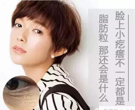 儿童脸上长一粒粒小疙瘩像脂肪粒,宝宝脸上起的类似脂肪粒的疙瘩