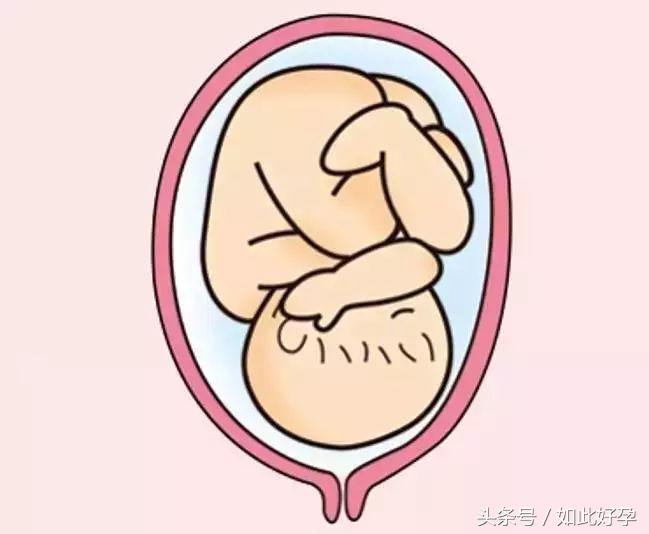 胎位不正的纠正方法是什么,胎位不正一般在孕多少周进行矫正