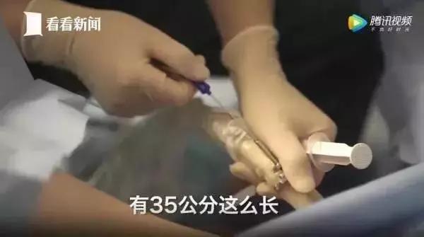 我的iphone,iphonexs用后体验