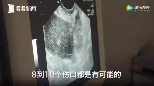 我的iphone,iphonexs用后体验