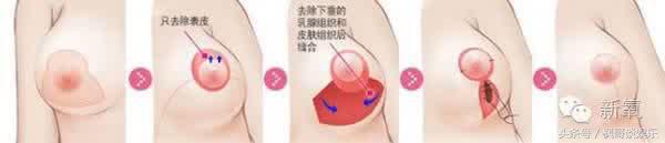 乳神柳岩变成这样，王菲志玲嘉玲纷纷表示不服！