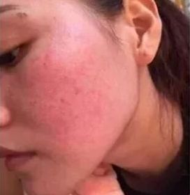 有了全世界3秒卖一瓶的“液体黄金“，干燥、长痘就与你无缘了！