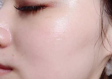 有了这瓶“液体黄金“,今年秋冬注定与干燥、长痘无缘了!