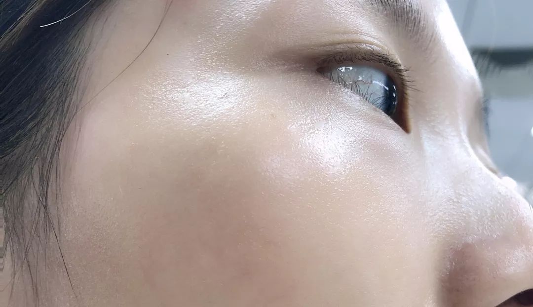 有了这瓶“液体黄金“,今年秋冬注定与干燥、长痘无缘了!