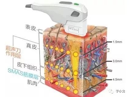 微商胶原蛋白是真的吗,微商胶原蛋白骗局揭秘