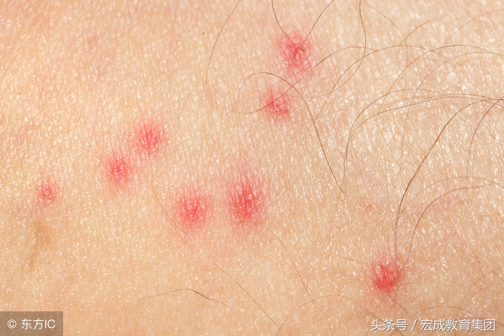 局限性神经功能障碍性皮肤病用药,常见的皮肤病用什么草药治疗