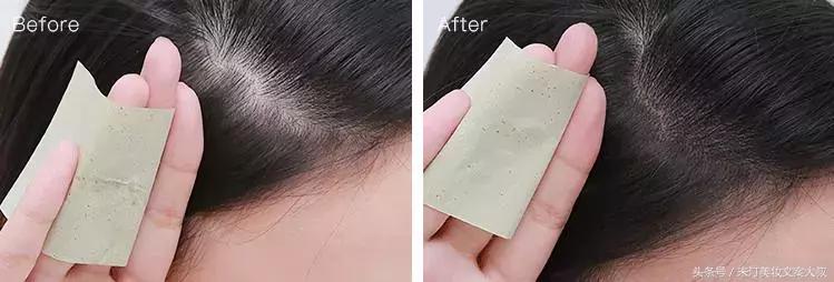 浣犺繕鍦ㄤ负浜嗚劚鍙戠儲鎭煎悧,浣犺繕鍦ㄤ负浣犺劚鍙戠儲鎭艰嚜鍗戝悧