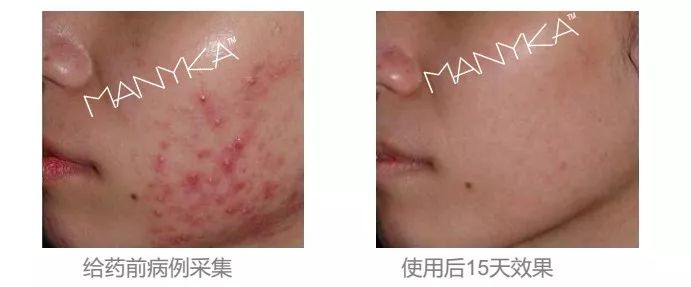 MANYKA(麦蜜卡)研发工程师专访:重新认识产品,从内而外