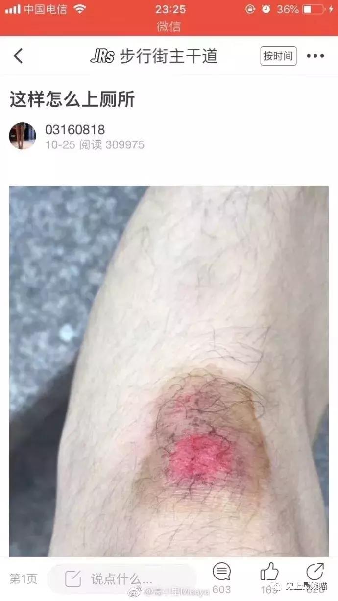 网友在微商那花5000买了个丁丁增大器？结果……