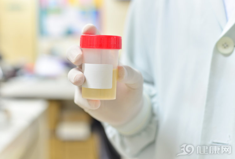 小便有泡沫一定是肾病吗,小便泡沫多是肾病的前兆吗