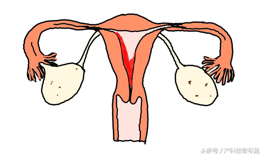 人流对身体损伤最小的方式,人流导致创伤怎么修复