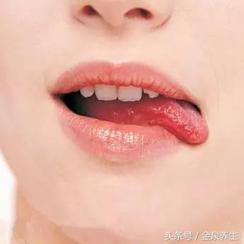 冬季嘴唇干裂适合喝什么汤,冬季孩子嘴唇红肿干裂老是舔