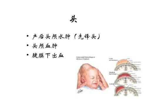宝宝一出生头上就长这种瘤怎么办!如何识别良性OR恶性?