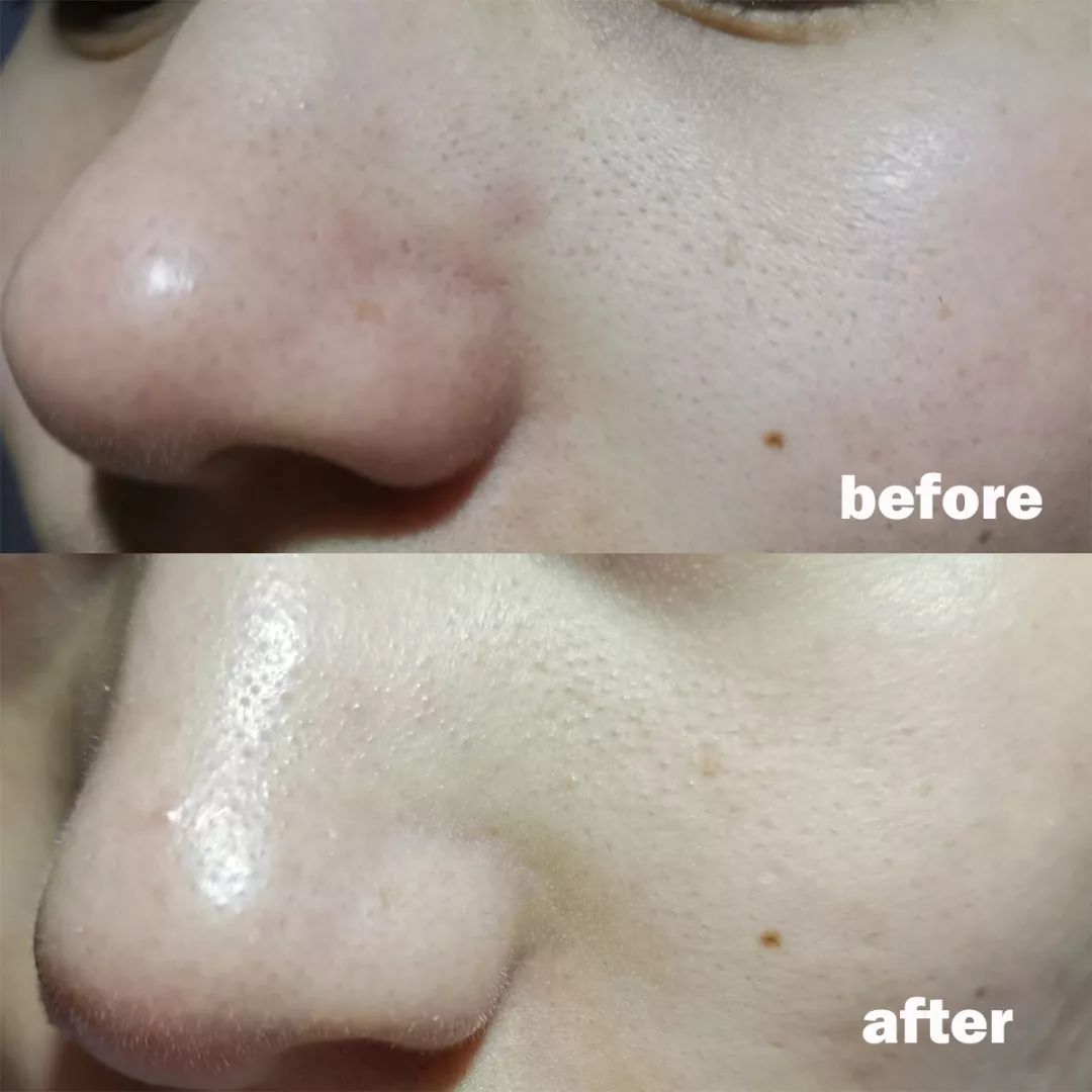 清洁面膜测评踩雷,清洁面膜测评排行榜前十位