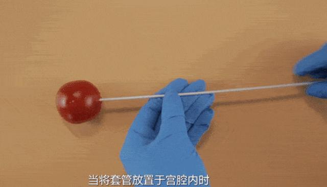 揭秘那些“可怕”的妇科检查—“肉疼”的刮宫