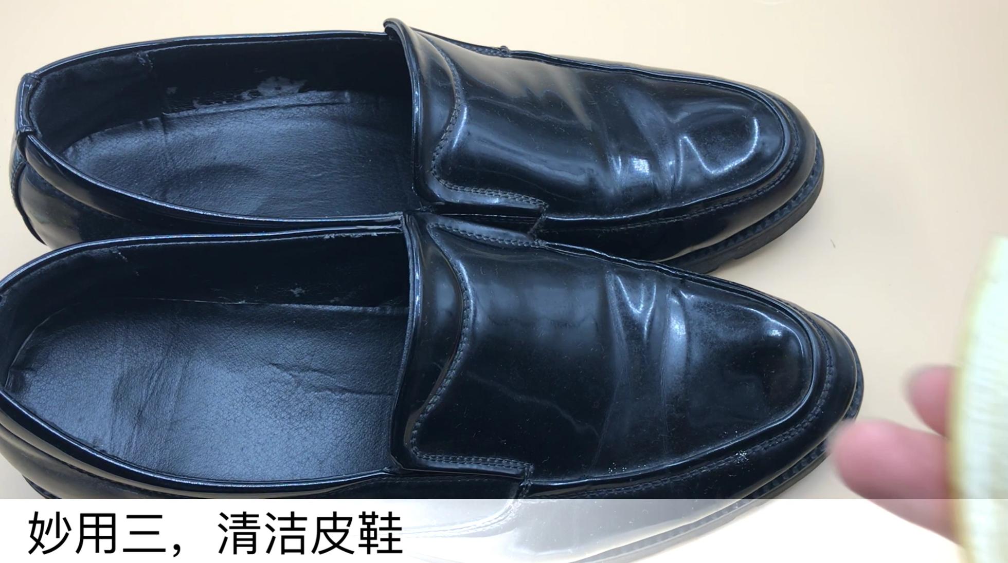 香蕉皮太厉害了，好多人的难题全都解决了，看完赶紧告诉家里人