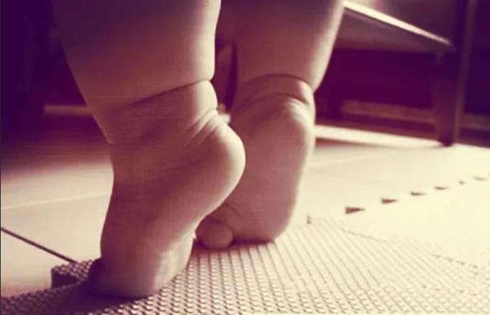 宝宝7个月就走路,担心以后O型腿?骨科医生教你3个方法自查