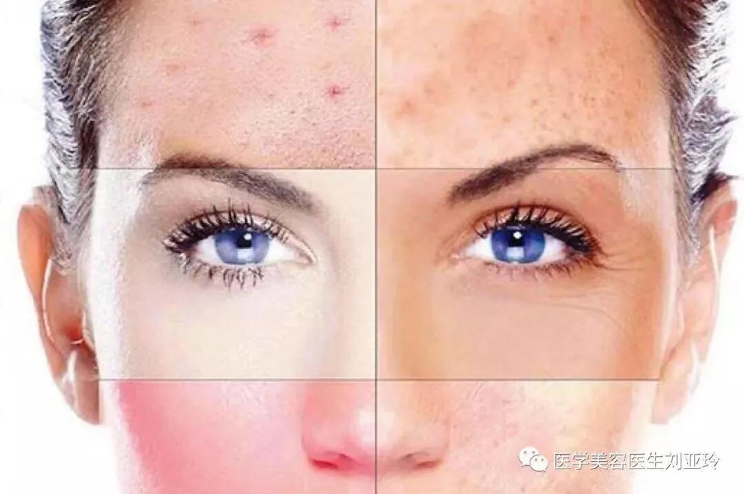 注射水光针为什么皮肤油亮,注射水光后皮肤干