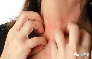 皮肤出现了很多小红点,皮肤上的小红点是怎么回事