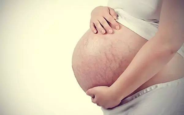 妊娠纹出现的前兆和过程,妊娠纹的前兆是什么
