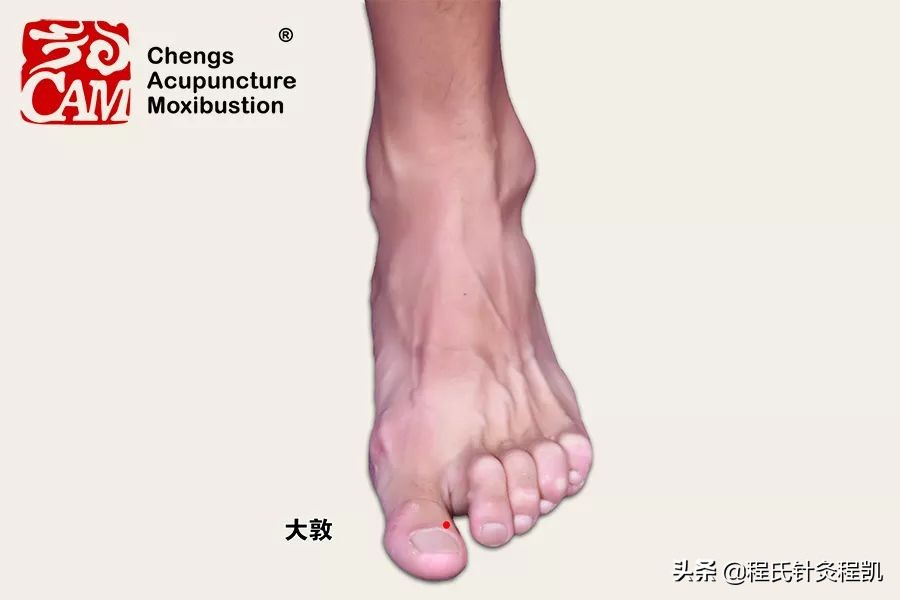 肝火旺头疼最快的下火方法,肝火大造成头晕按哪些穴位